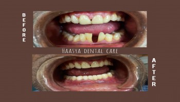 Have you have your movable teeth examined