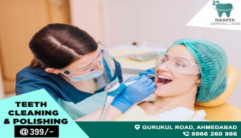 Teeth Cleaning & Polishing