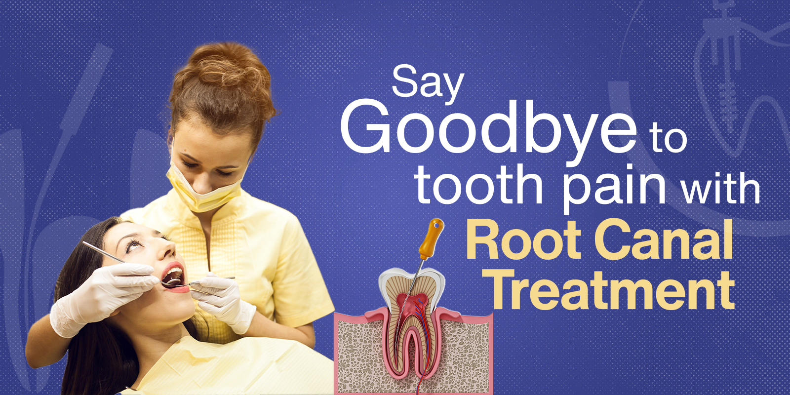 Root Canal Treatment