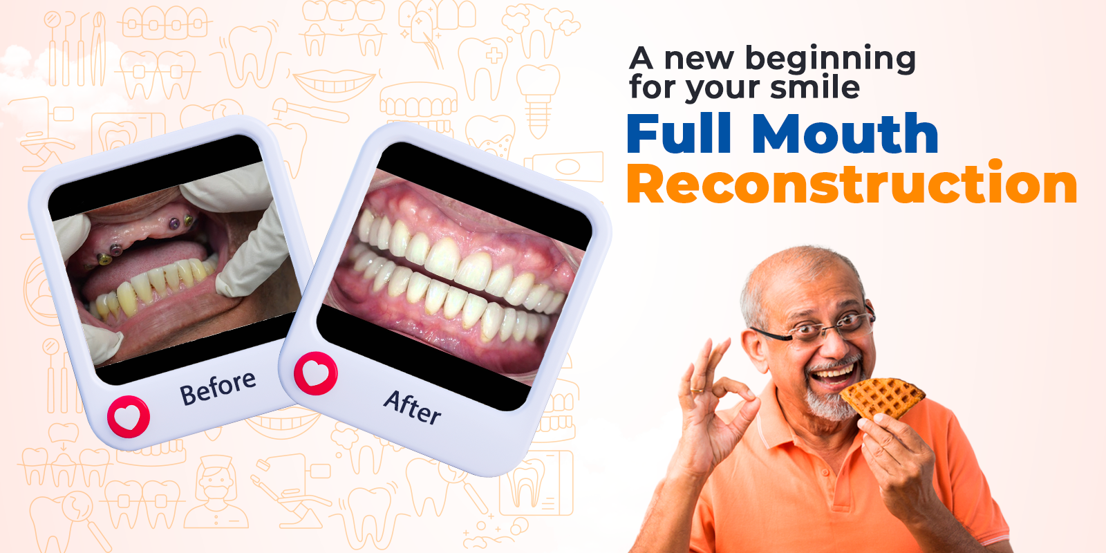 Full Mouth Reconstruction