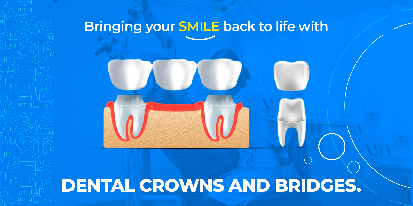 Dental Crowns & Bridges