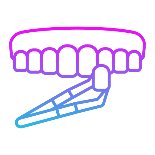 Dental Veneer