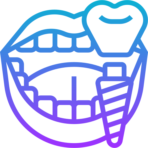 Full Mouth Reconstruction